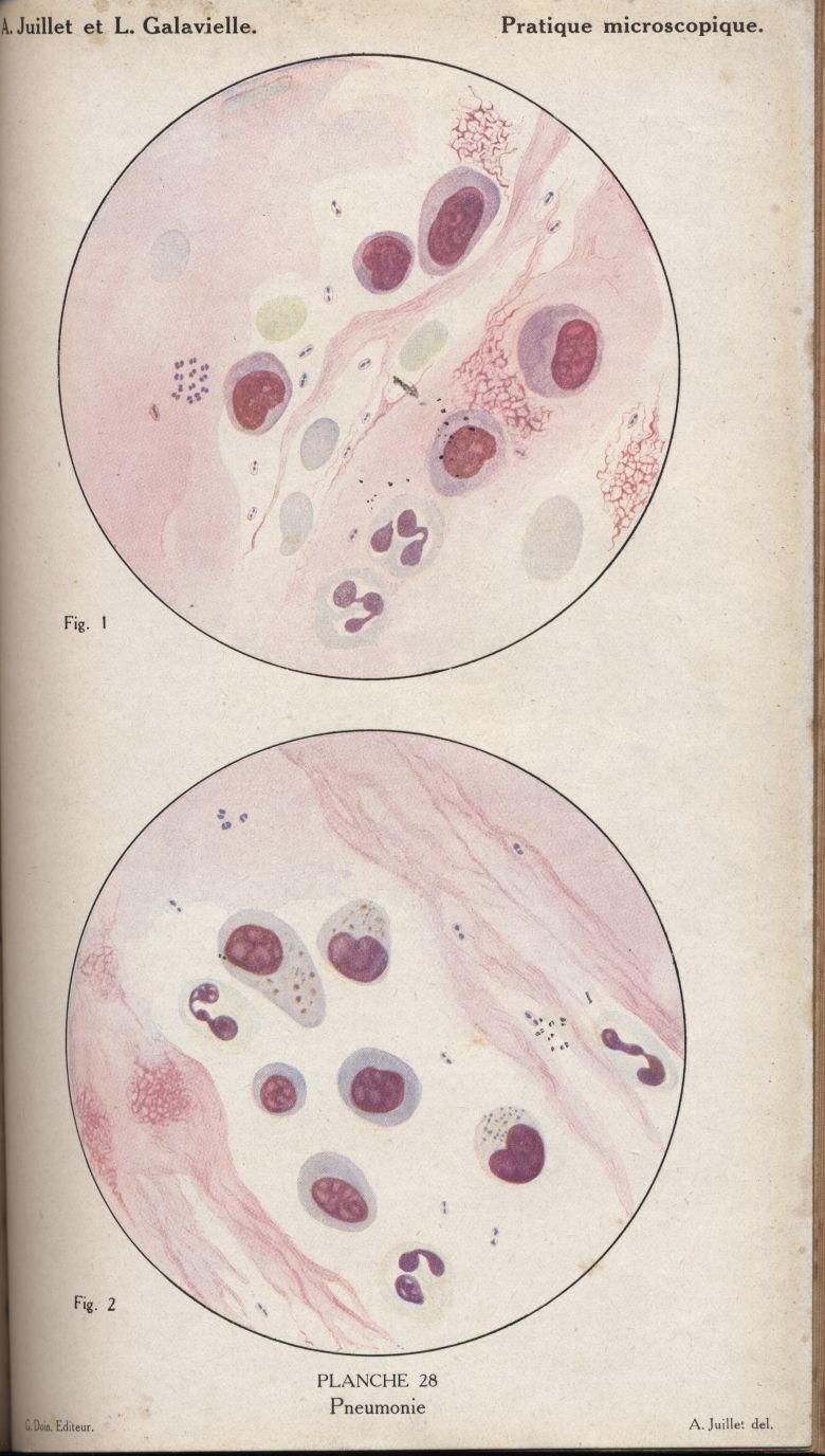 almicrolib31b